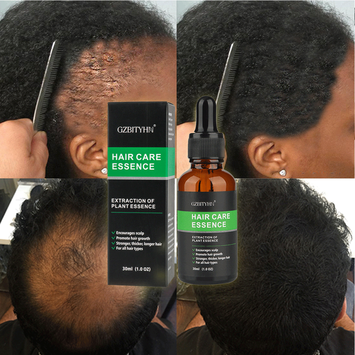 HAIR CARE ESSENCE - GZBITYHN